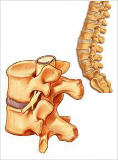 tratamentul coloanei vertebrale și al articulațiilor este încurajator)